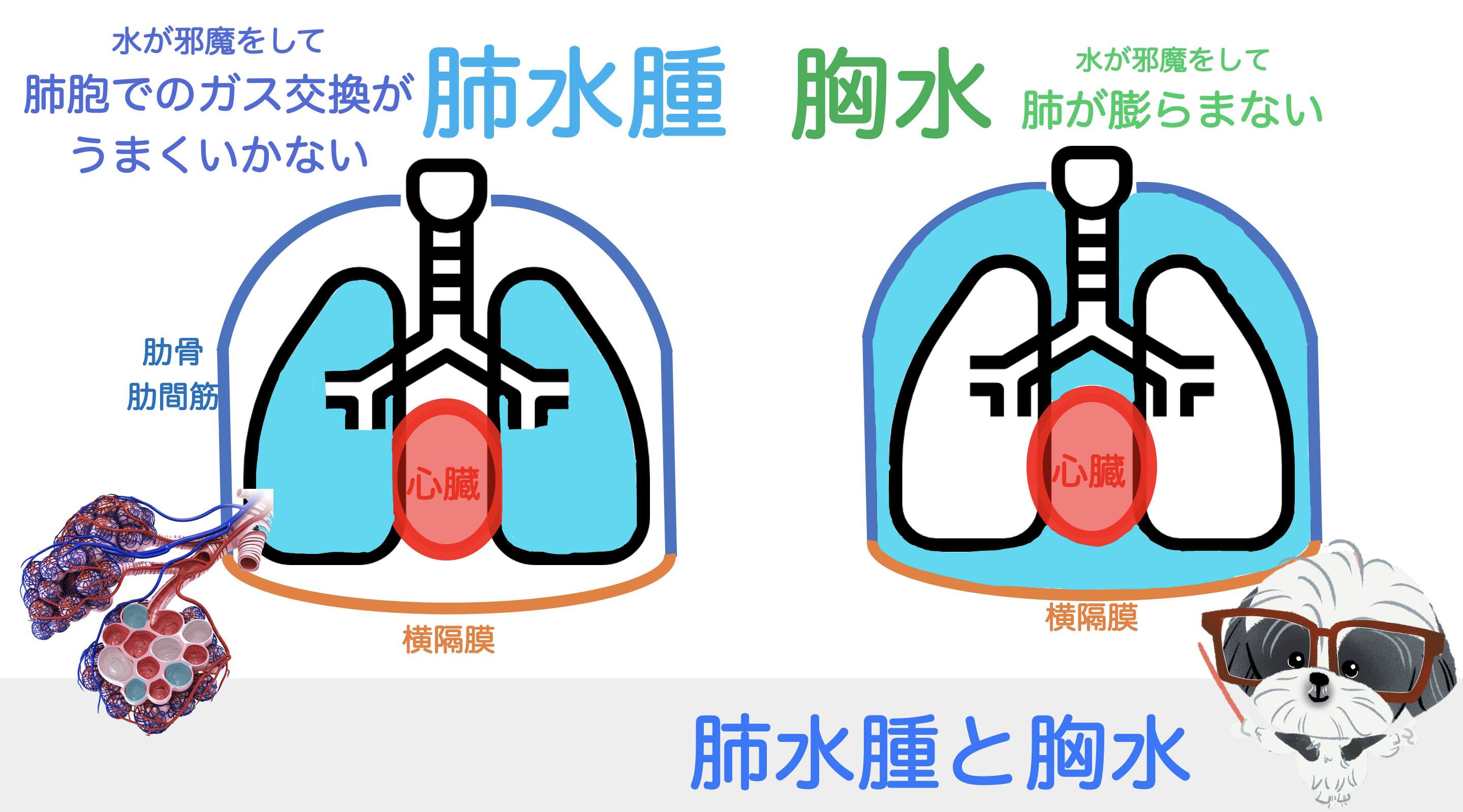 水疱性肺気腫 (BE) は深刻ですか?
